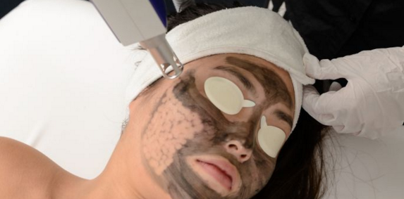 During the Carbon facial treatment