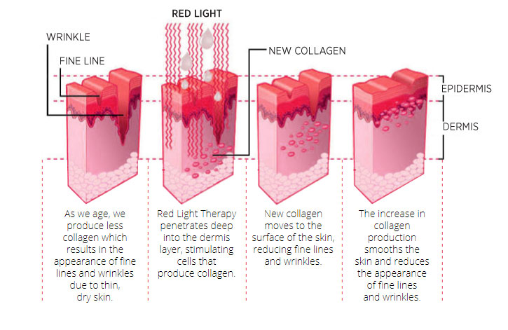 blue&red light therapy